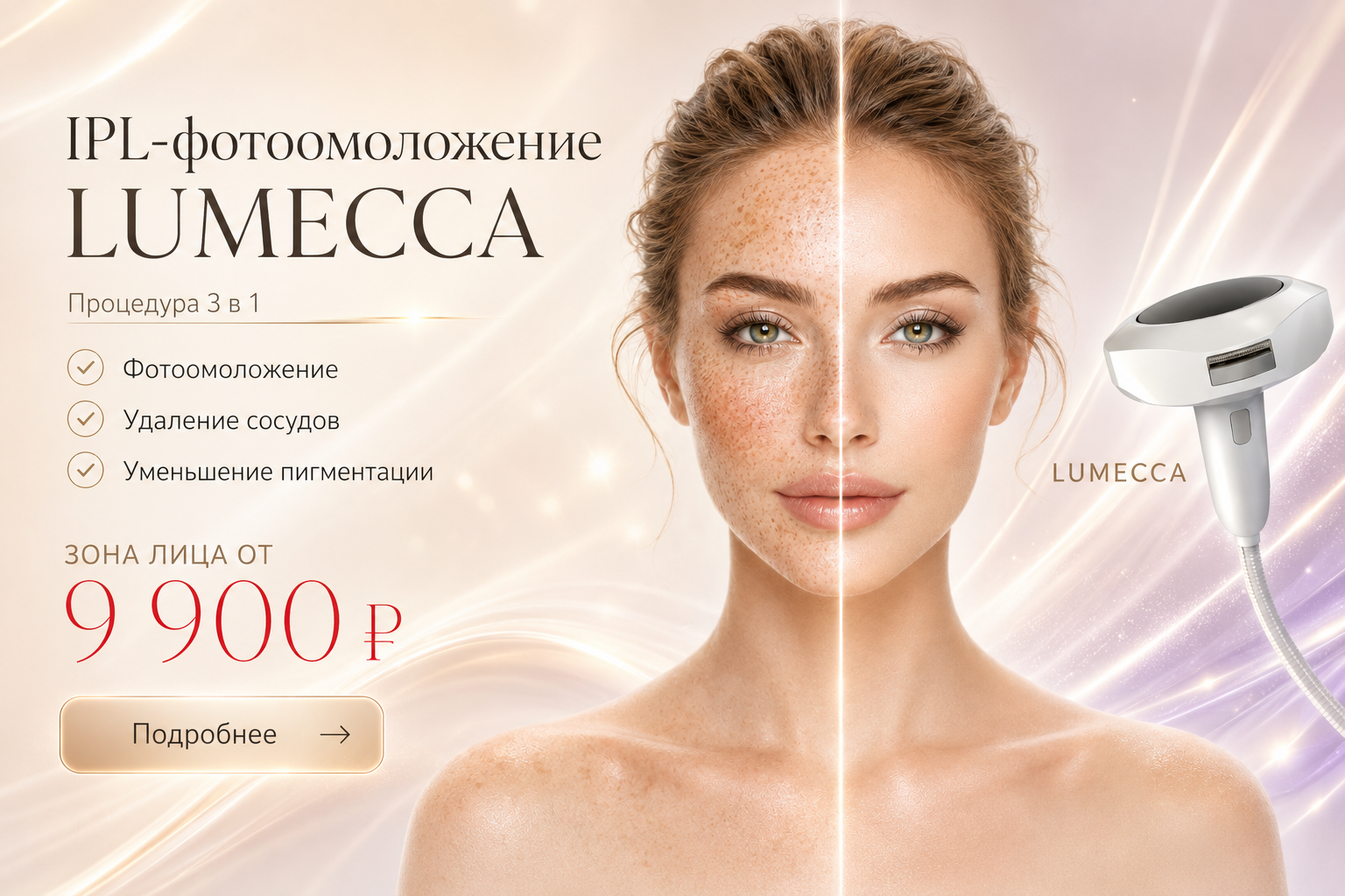 Люмека слайд 1