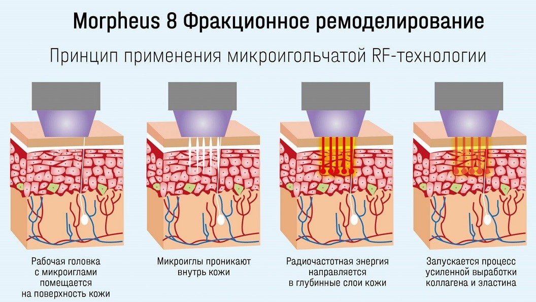 Механизм действия