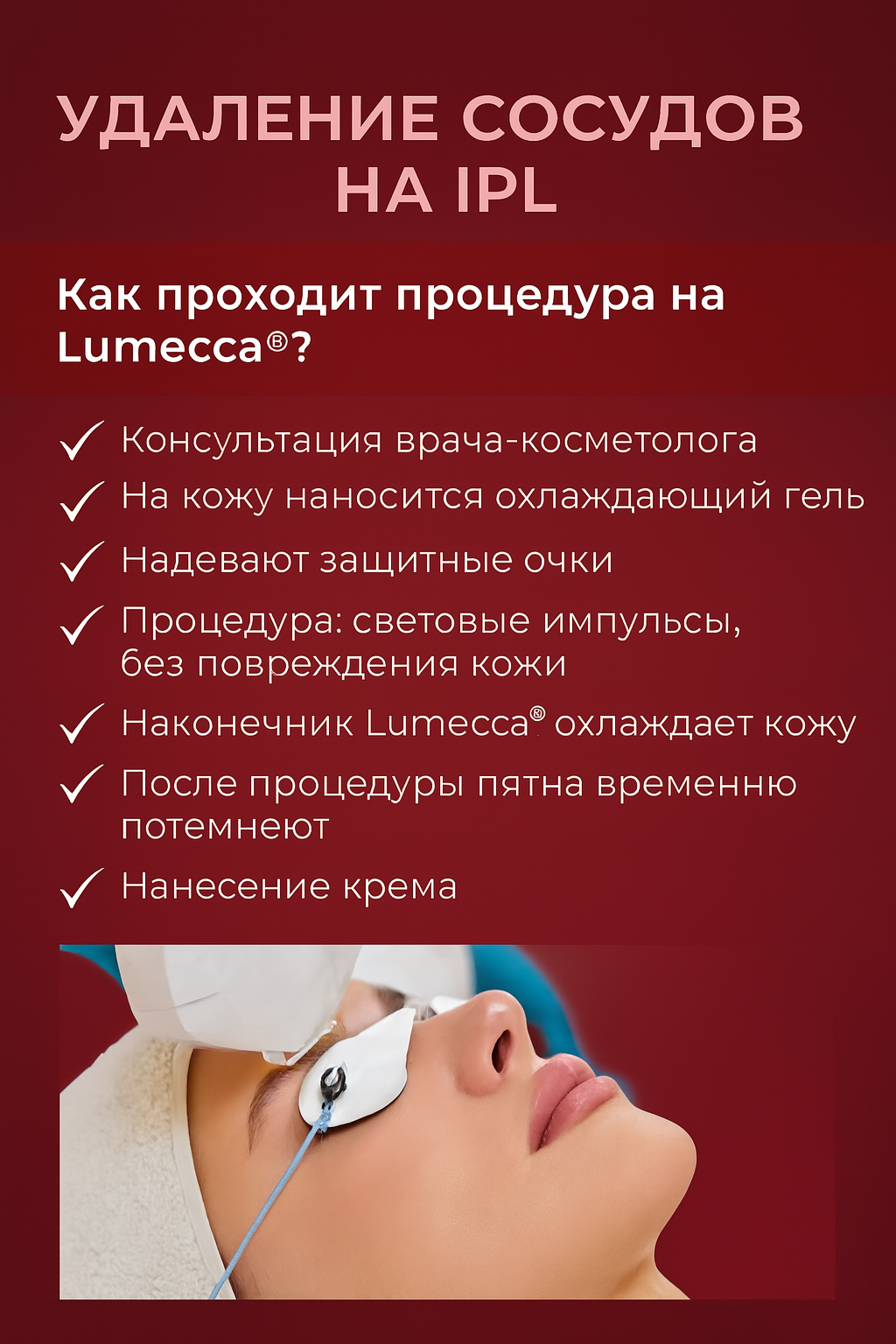 IPL - Удаление сосудов 11200р.