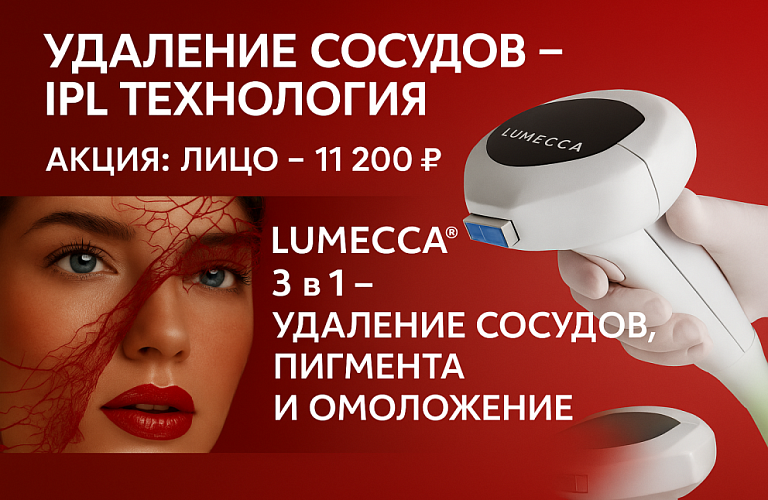 IPL - Удаление сосудов 11200р.