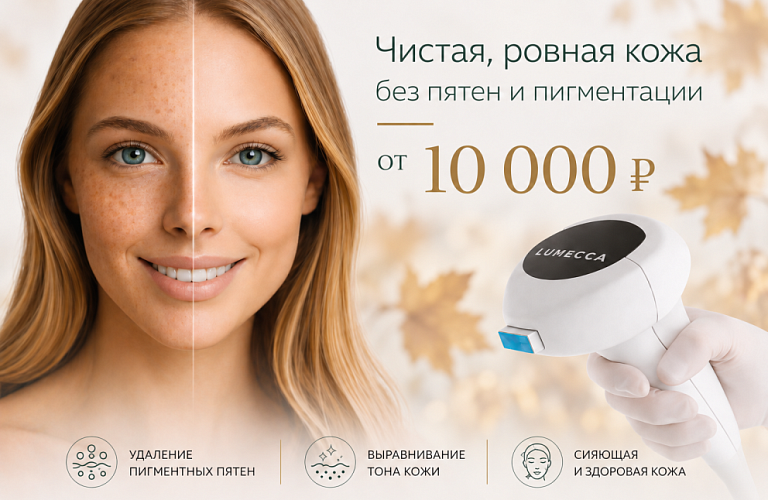 Удаление пигментных пятен от 10000р.