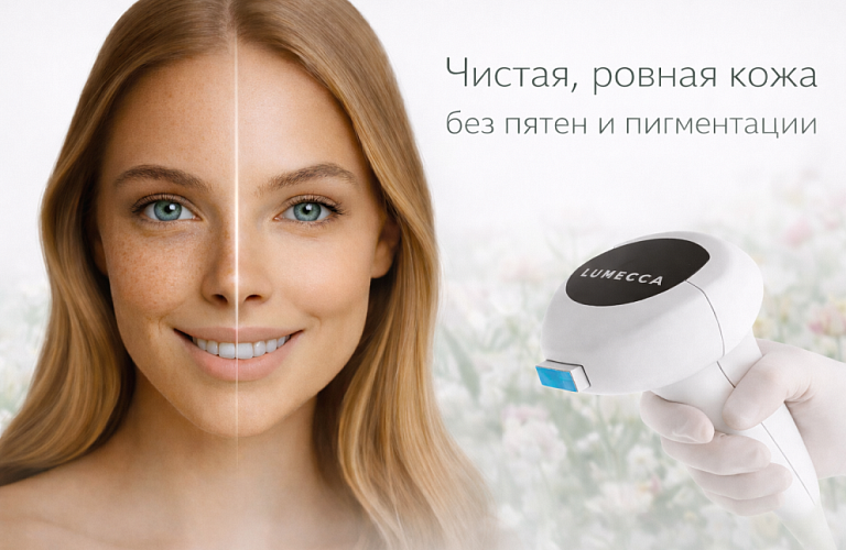 Удаление пигментных пятен от 9900р.