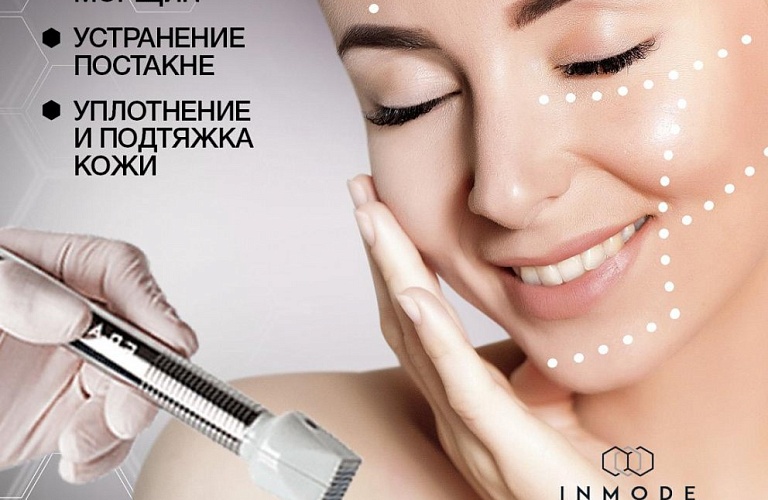 RF-лифтинг или СМАС МРТ - Минус 10 лет