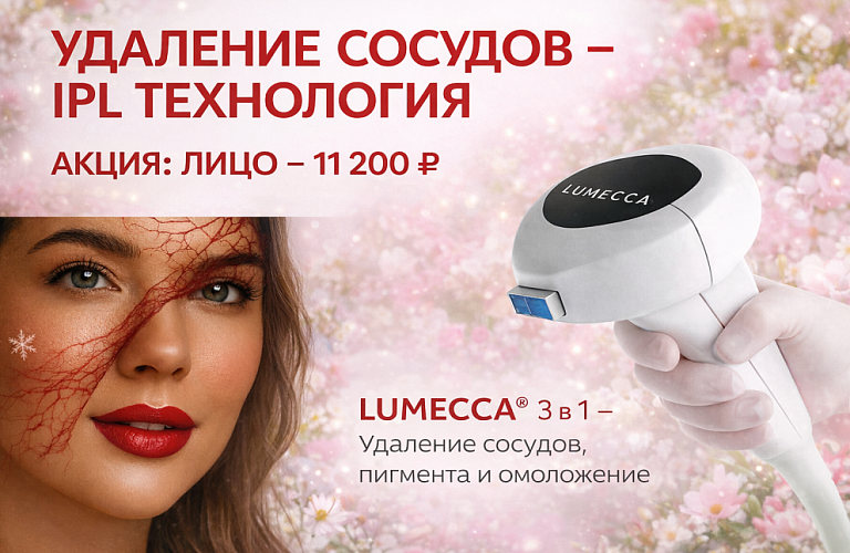 IPL - Удаление сосудов 11200р.