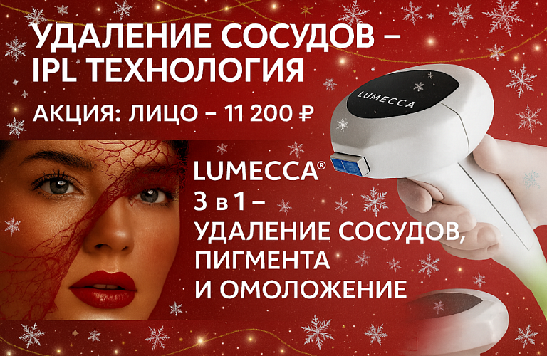 IPL - Удаление сосудов 11200р.